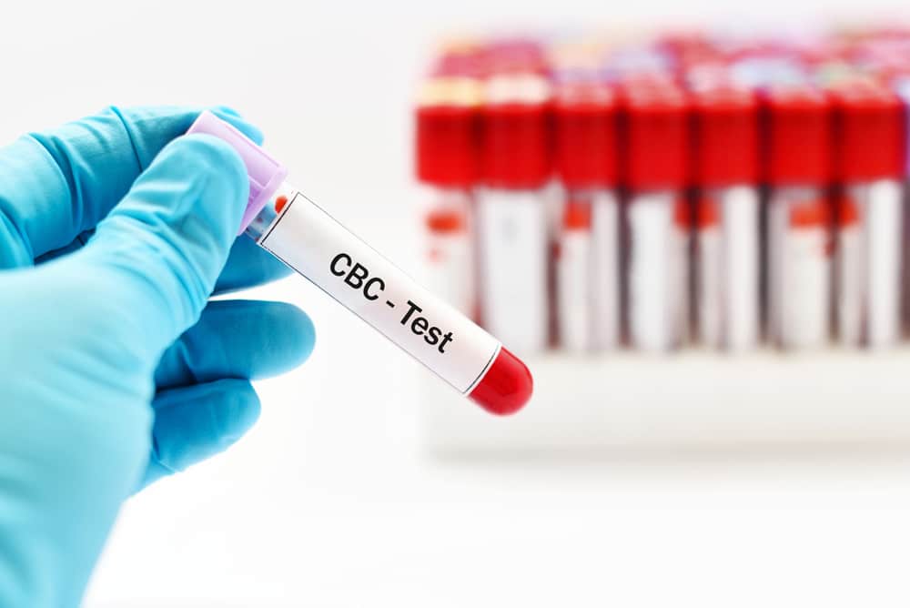 complete blood count with platelets, cbc test