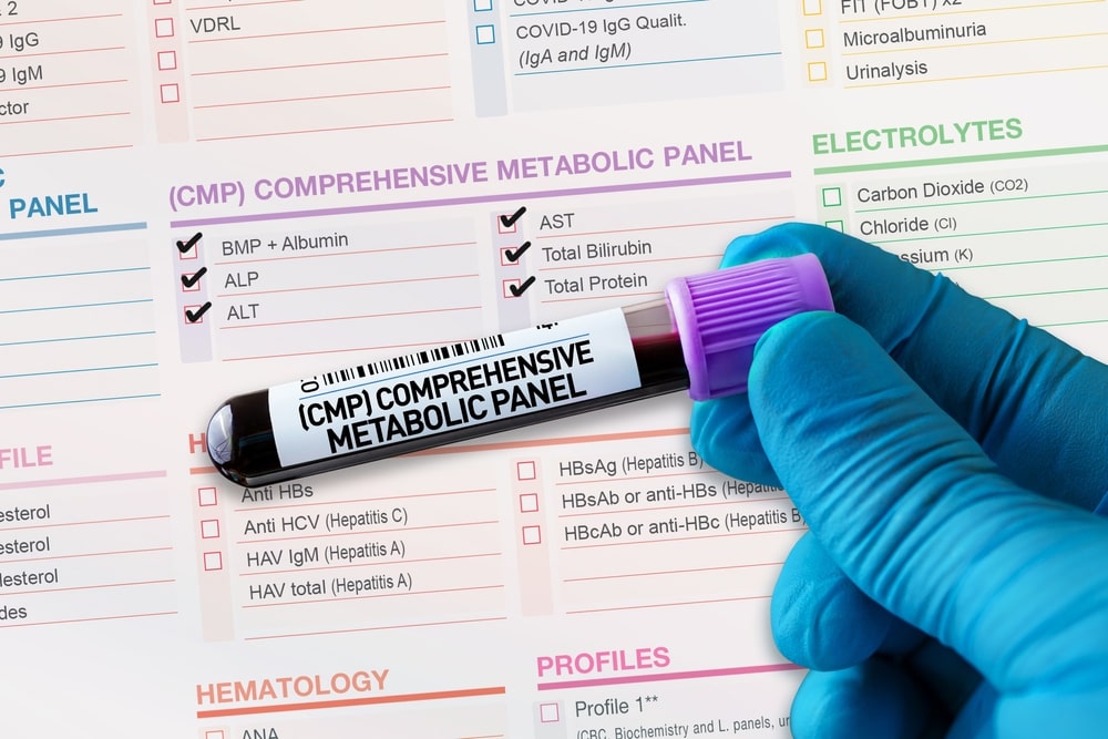 comprehensive metabolic profile test, cmp test