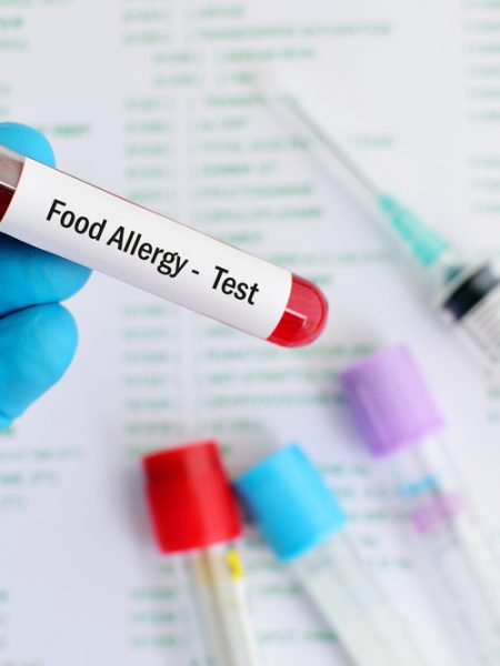 food allergy test, food sensitivity testing