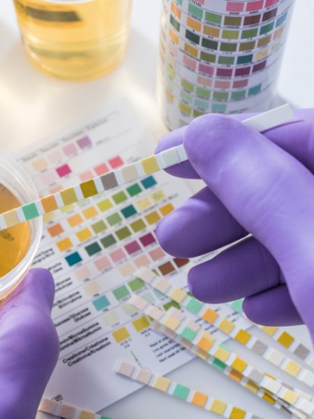 urinalysis test