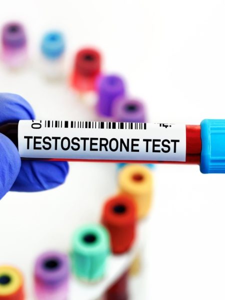 testosterone blood test