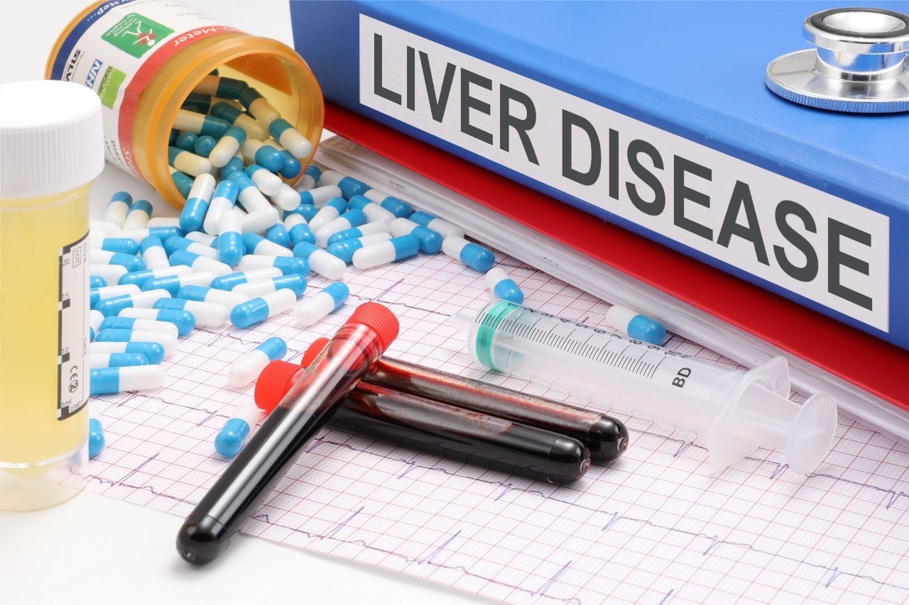 liver function panel test